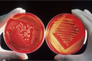 Infectious diseases small